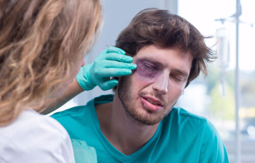 As principais lesões oculares causadas em decorrência de acidentes