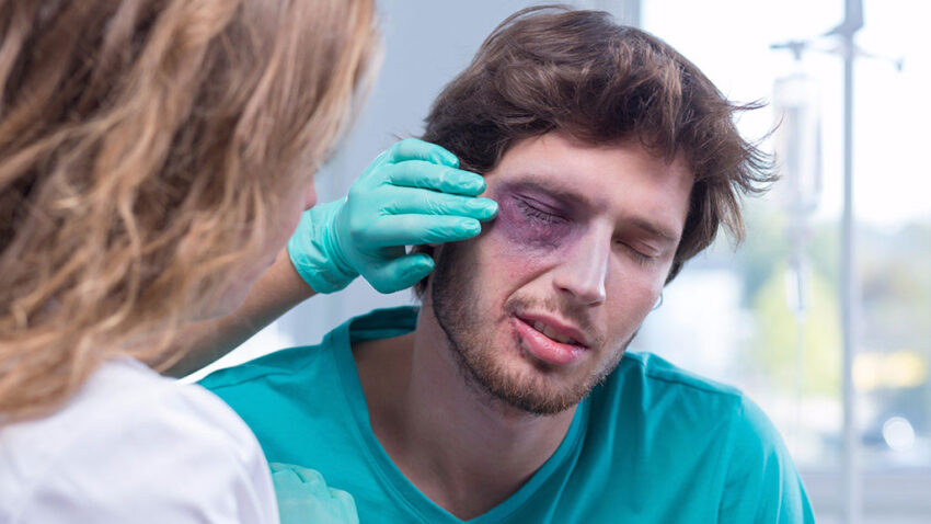 As principais lesões oculares causadas em decorrência de acidentes