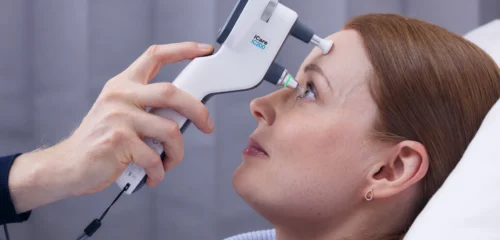 Tonometria de Rebote (iCare) e de Goldmann