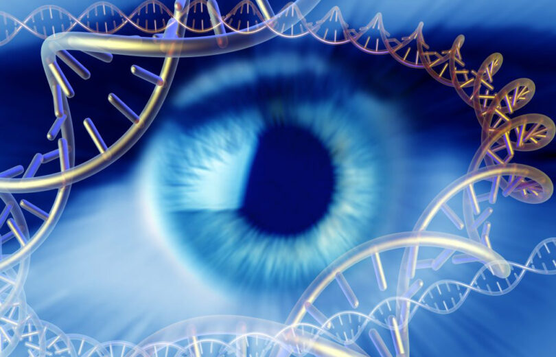 Glaucoma e a importância de conhecer o histórico de doenças oculares da sua família