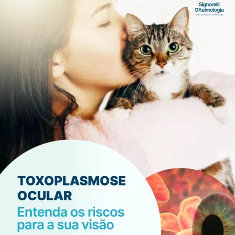 Toxoplasmose Ocular: entenda os riscos para a sua visão