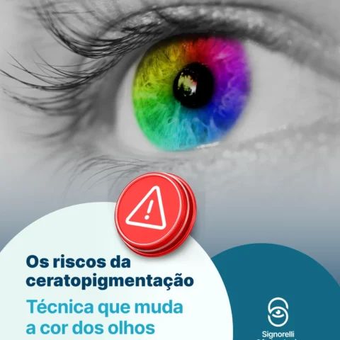 Ceratopigmentação: quando a estética coloca sua visão em risco