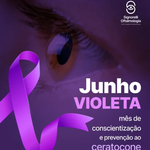 O mês de junho é dedicado ao ceratocone com a campanha Junho Violeta!