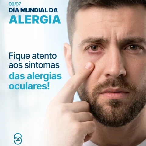Dia Mundial da Alergia – Fique atento às alergias oculares