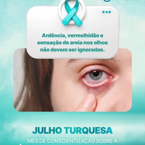Julho Turquesa | Mês de Conscientização sobre a Síndrome do Olho Seco   
